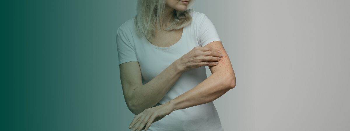 Eczeem & Psoriasis: oorzaken, impact en orthomoleculaire oplossingen
